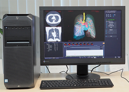 医用画像処理ワークステーション「Ziostation2」(HP Z6 G4 Workstation+NVIDIA Quadro RTX 5000を使用) 医用画像処理ワークステーション「Ziostation2」(HP Z6 G4 Workstation+NVIDIA Quadro RTX 5000を使用)