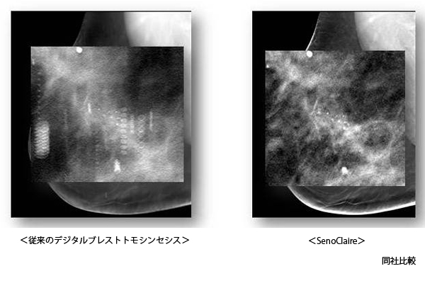 比較画像 比較画像