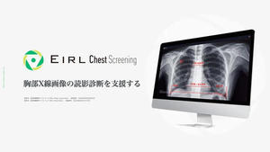 EIRL Chest Screening EIRL Chest Screening