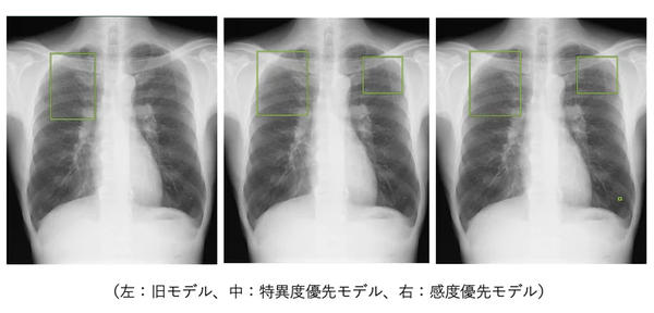 事例<1> 事例<1>