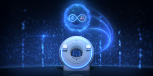 SmartSpeed Precise