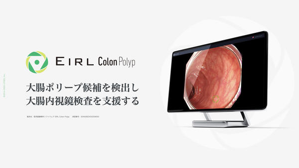 EIRL Colon Polyp EIRL Colon Polyp